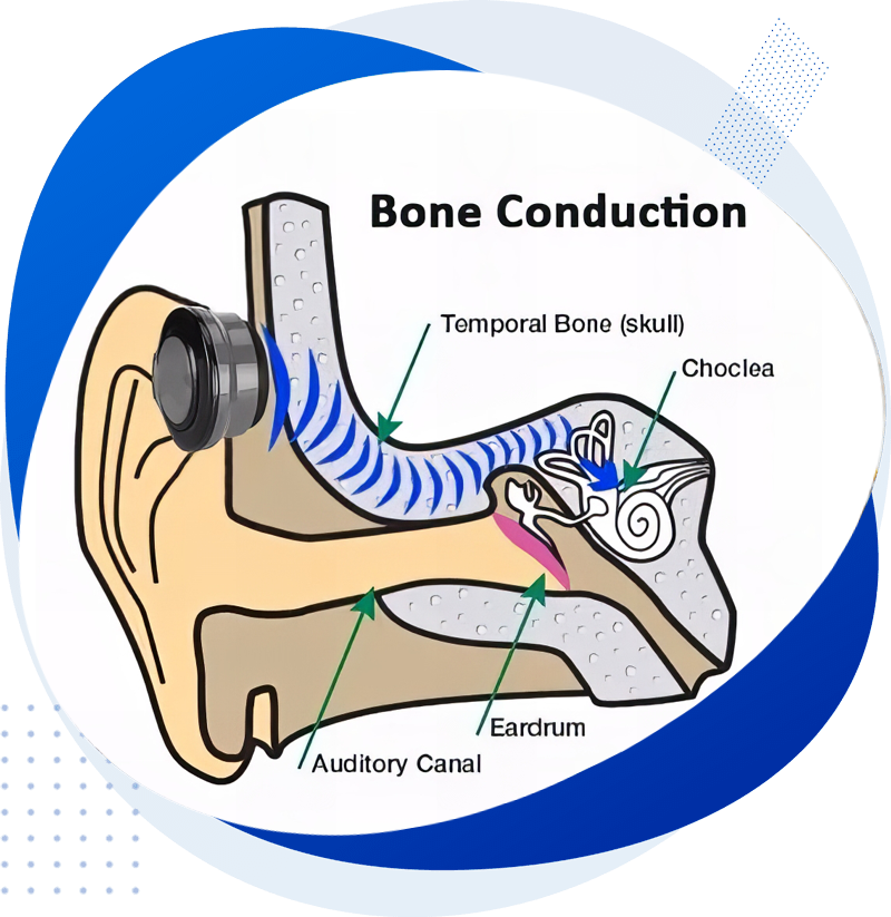 Bone conduction Bone conduction